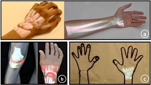 three presentation surfaces